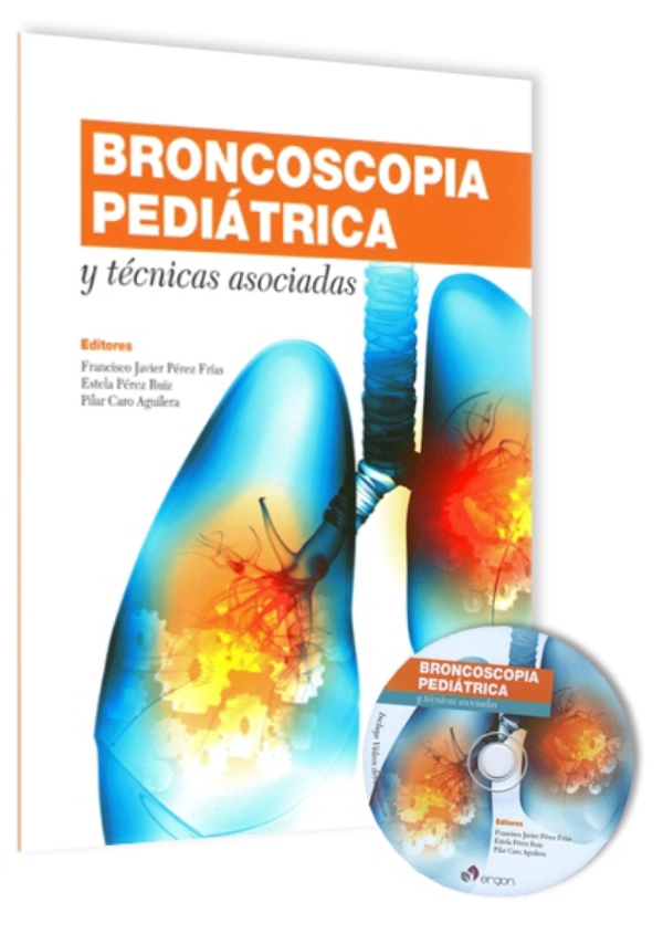 Broncoscopia pediátrica y técnicas asociadas en LALEO