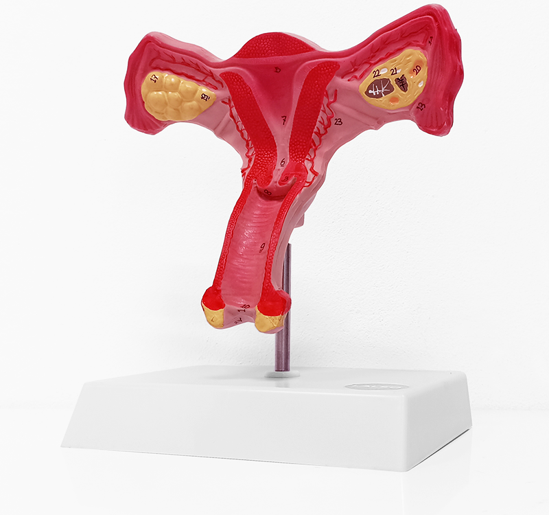 Modelo Anatómico De Útero Femenino Y Ovario Con Números En Laleo 1120