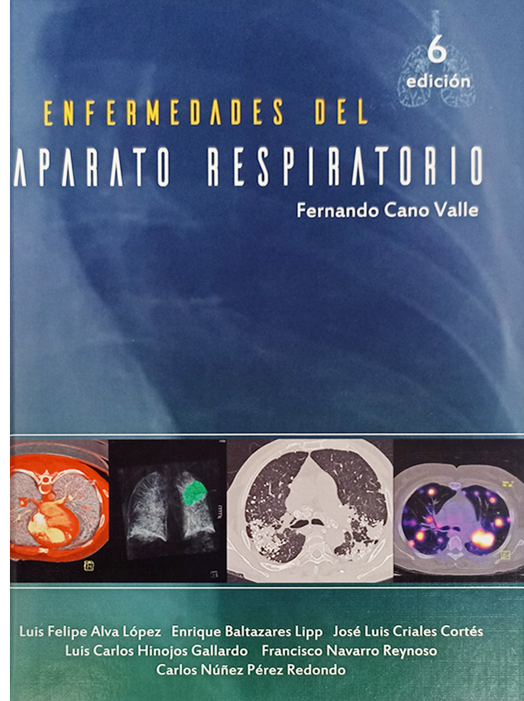 Cuidados Intensivos Del Sistema Respiratorio En Laleo 2003