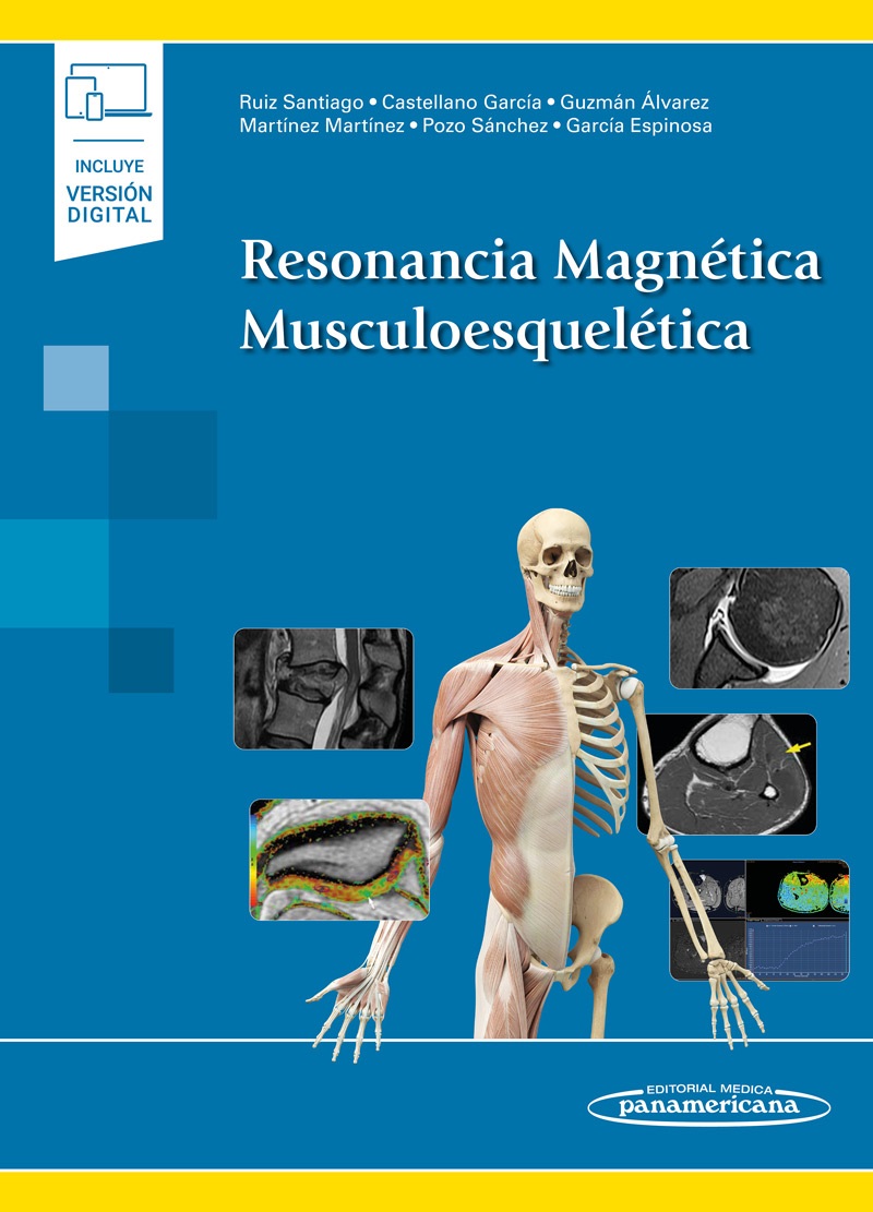 Resonancia Magnética Musculoesquelética En Laleo