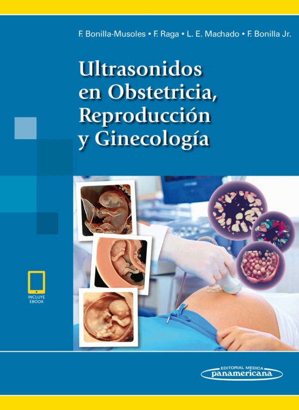 Bonilla. Ultrasonidos En Obstetricia, Reproducción Y Ginecología En LALEO