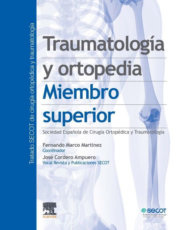 El Olimpo (Traumatologia y Ortopedia)