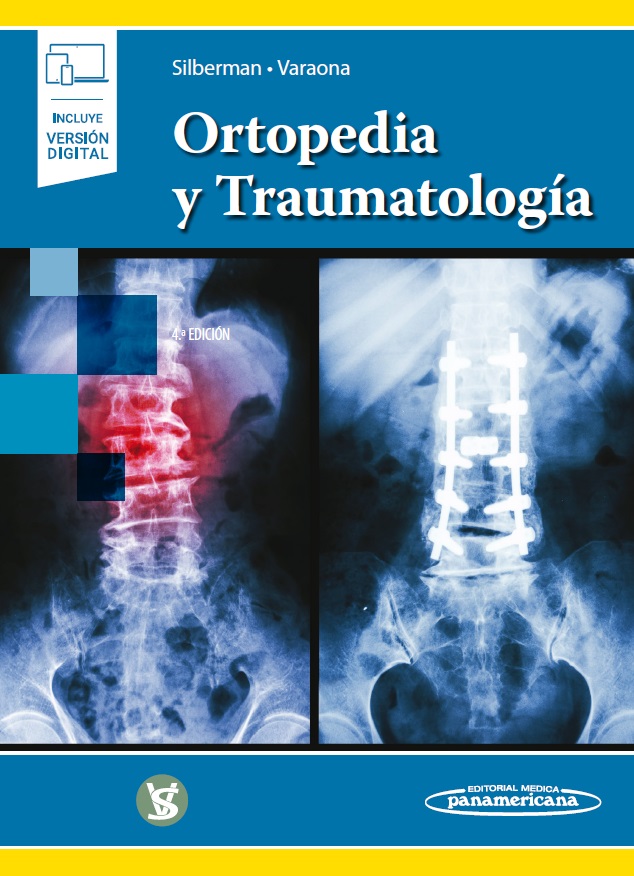 Ortopedia Y Traumatología En LALEO