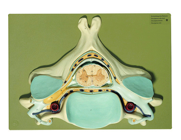 Modelo Anatómico: Quinta vertebra cervical, con medula espinal y orígenes  de nervios en LALEO