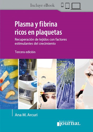 https://api.laleo.com/public/images/ACCESORIOS/thumbs/laleo_9789878452289-plasma-y-fibrina-ricos-en-plaquetas-recuperacion-de-tejidos-con-factores-estimulantes-del-crecimiento.png