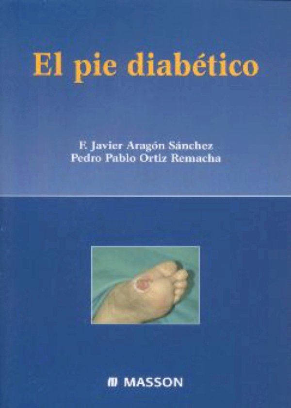 Aragón. El pie diabético en LALEO