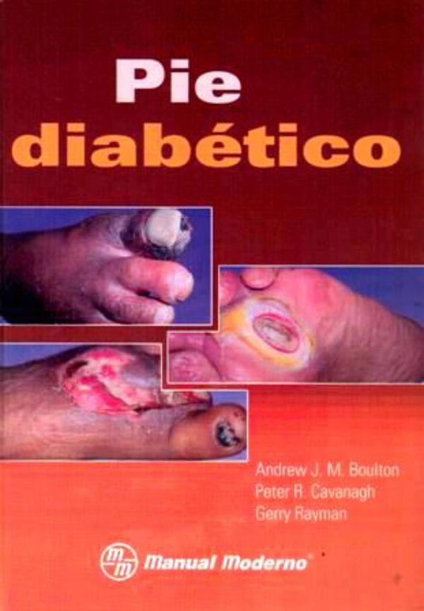 Pie diabético en LALEO