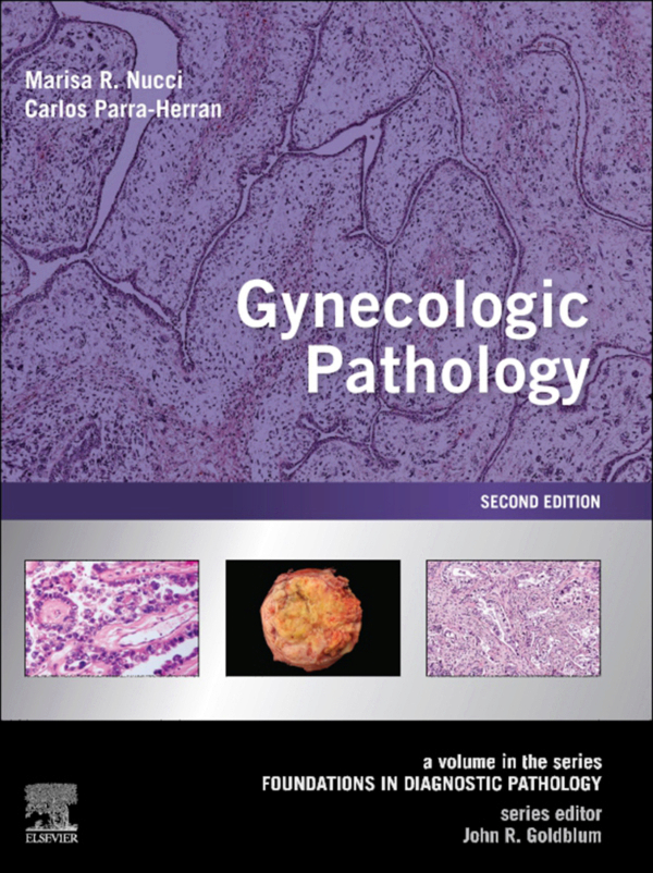 Gynecologic Pathology E-Book (ebook) en LALEO