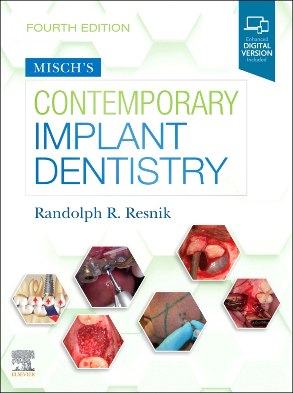 Misch's Contemporary Implant Dentistry EBook (ebook) en LALEO