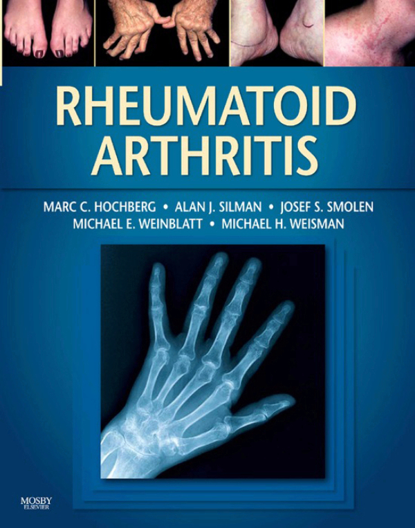 Rheumatoid Arthritis (ebook) en LALEO