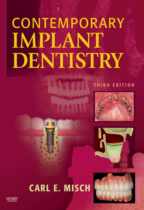 Contemporary Implant Dentistry (ebook) en LALEO