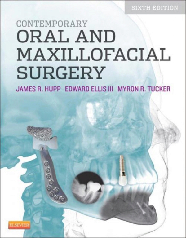 Contemporary Oral And Maxillofacial Surgery Ebook En Laleo