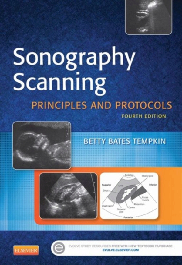 Sonography Scanning (ebook) en LALEO