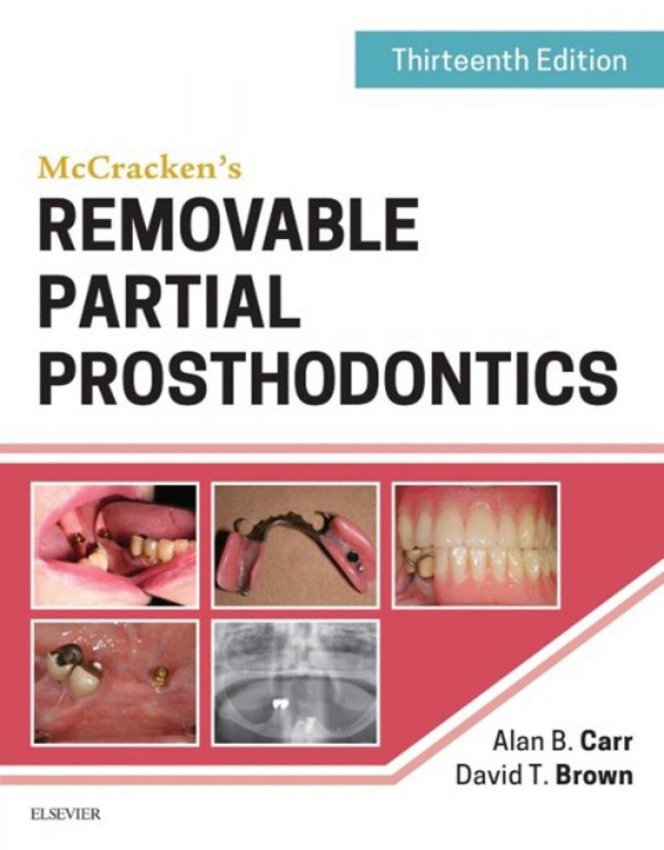 McCracken's Removable Partial Prosthodontics (ebook) en LALEO