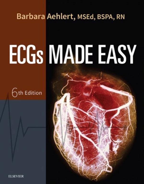 ECGs Made Easy - E-Book (ebook) En LALEO