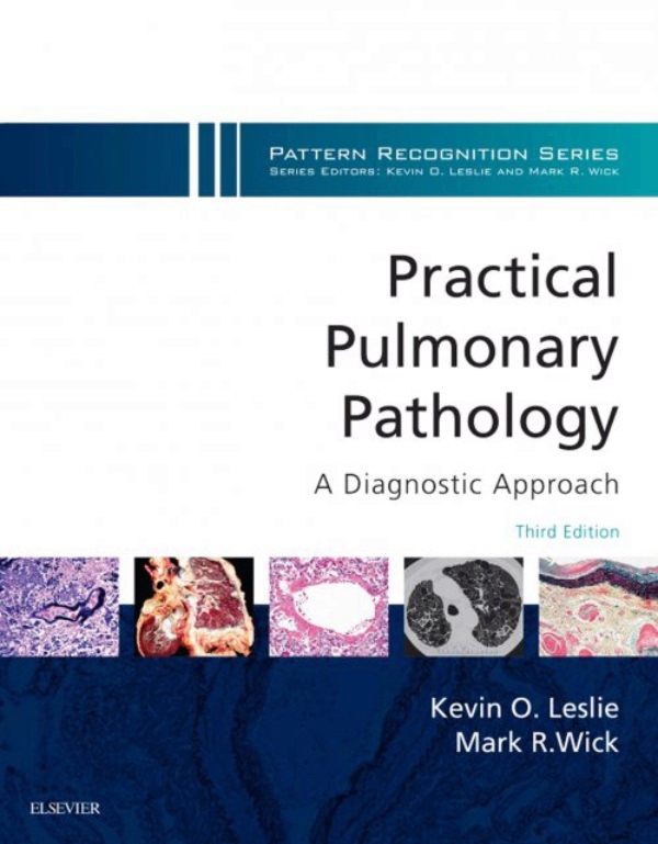 Practical Pulmonary Pathology: A Diagnostic Approach E-Book (ebook) en ...