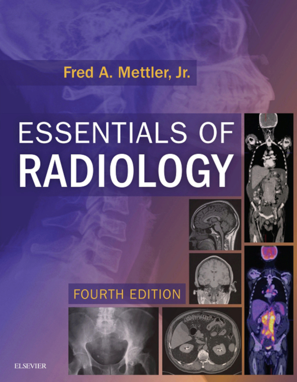 Essentials of Radiology EBook (ebook) en LALEO
