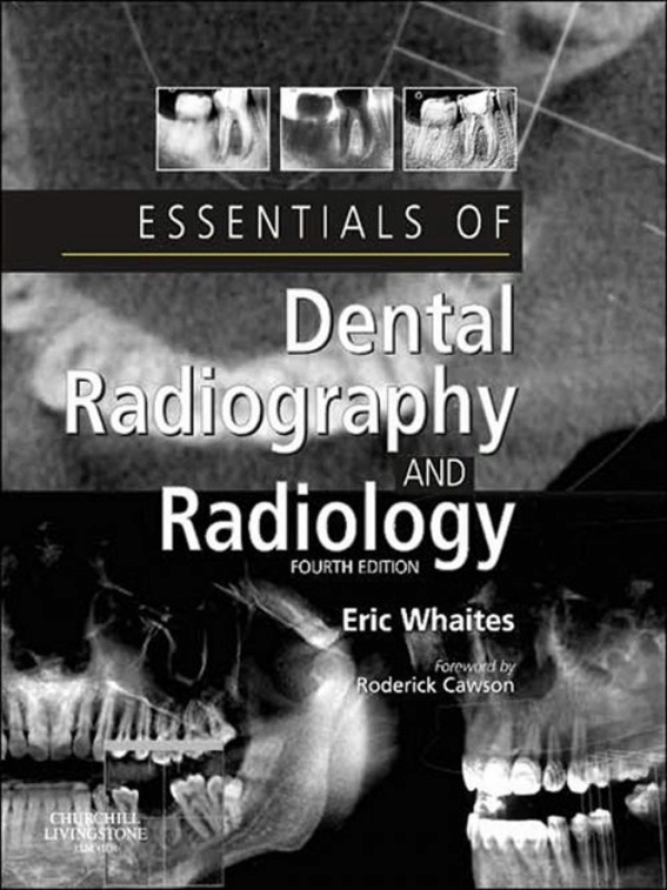 Essentials of Dental Radiography and Radiology (ebook) en LALEO