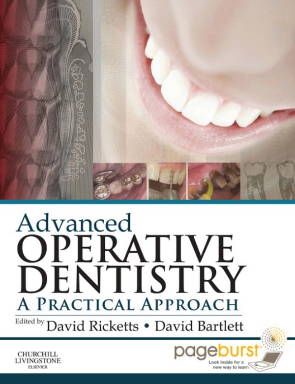 Advanced Operative Dentistry (ebook) en LALEO