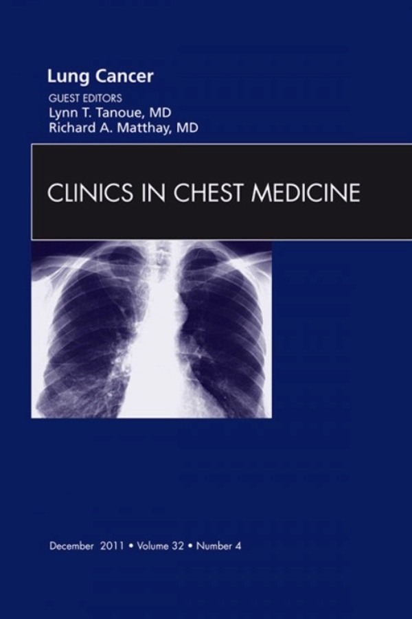 Lung Cancer An Issue Of Clinics In Chest Medicine Ebook En Laleo 3612