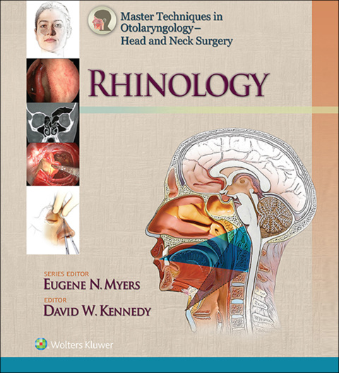 Master Techniques In Otolaryngology Head And Neck Surgery Rhinology ...