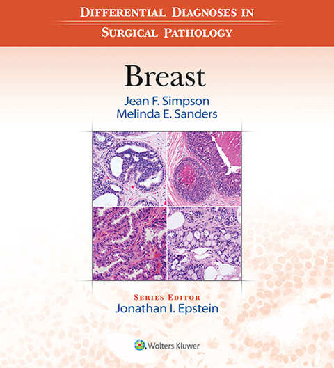 Differential Diagnoses In Surgical Pathology Breast (ebook) En LALEO