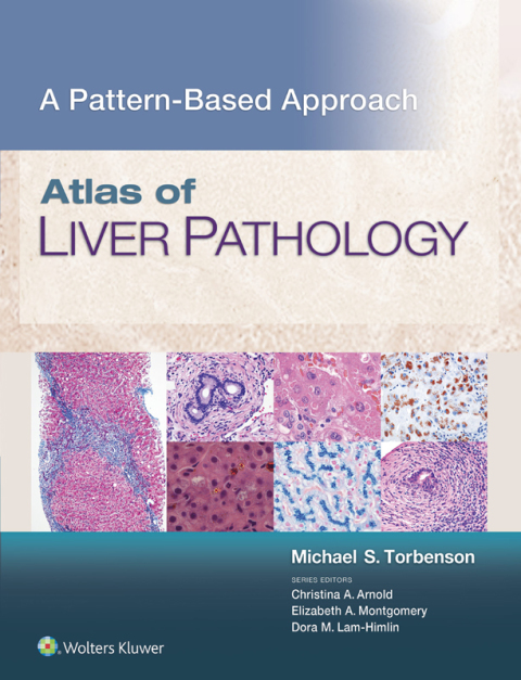 Atlas of Liver Pathology A PatternBased Approach (ebook) en LALEO