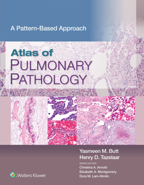 Atlas of Pulmonary Pathology (ebook) en LALEO