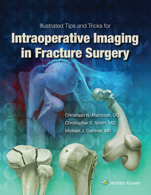 Illustrated Tips And Tricks For Intraoperative Imaging In Fracture