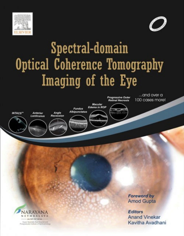 Spectraldomain Optical Coherence Tomography Imaging of the Eye (ebook