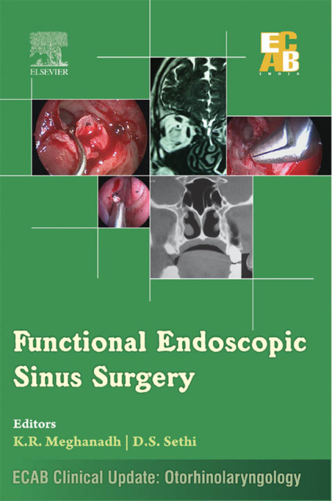 Functional Endoscopic Sinus Surgery - ECAB (ebook) en LALEO