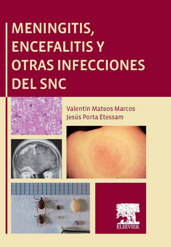 Meningitis, Encefalitis Y Otras Infecciones Del SNC (ebook) En LALEO