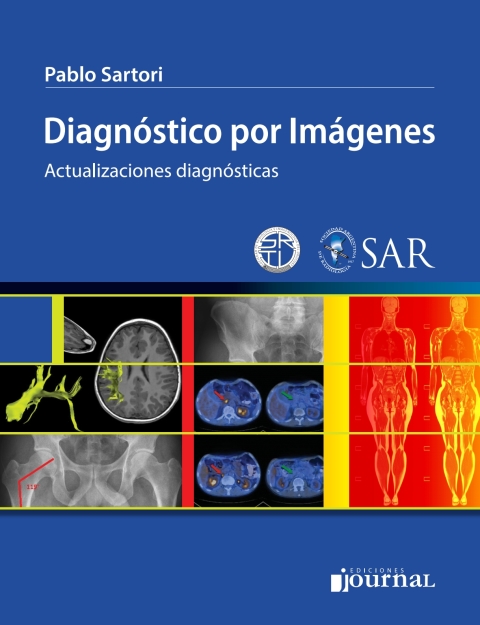 Diagnostico Por Imagenes Actualizaciones Diagnosticas Ebook En Laleo 9458