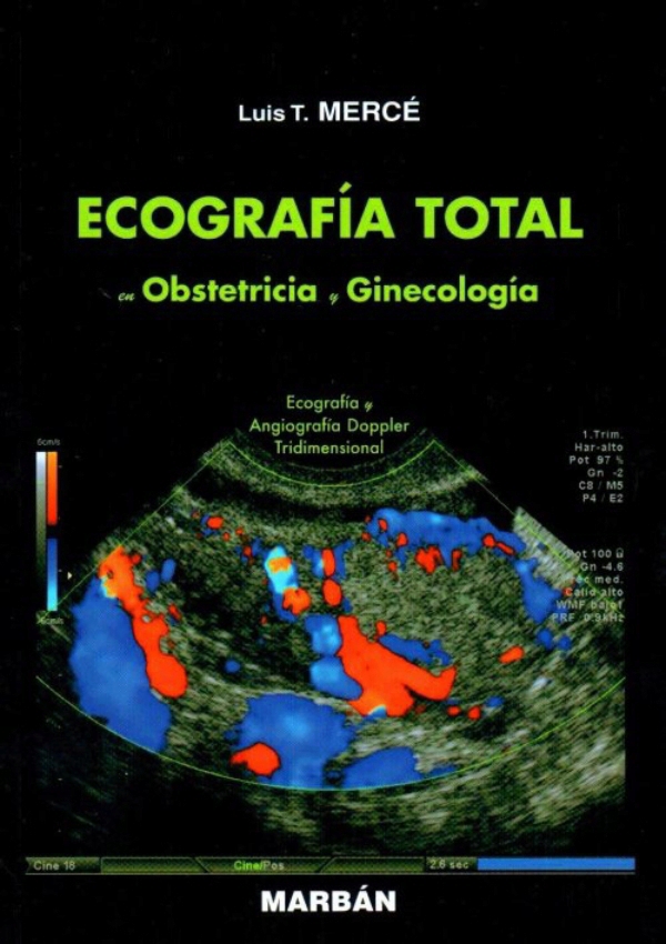 Ecografía Total En Obstetricia Y Ginecología En Laleo 3030