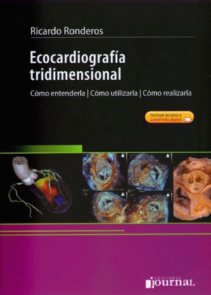 Ronderos Ecocardiografía Tridimensional en LALEO