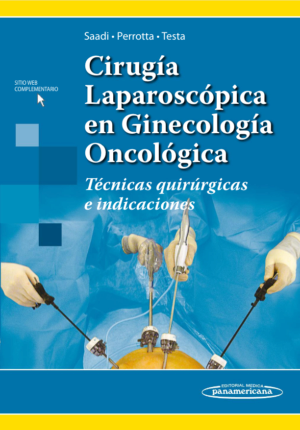 Cirugía Laparoscópica en Ginecología Oncológica