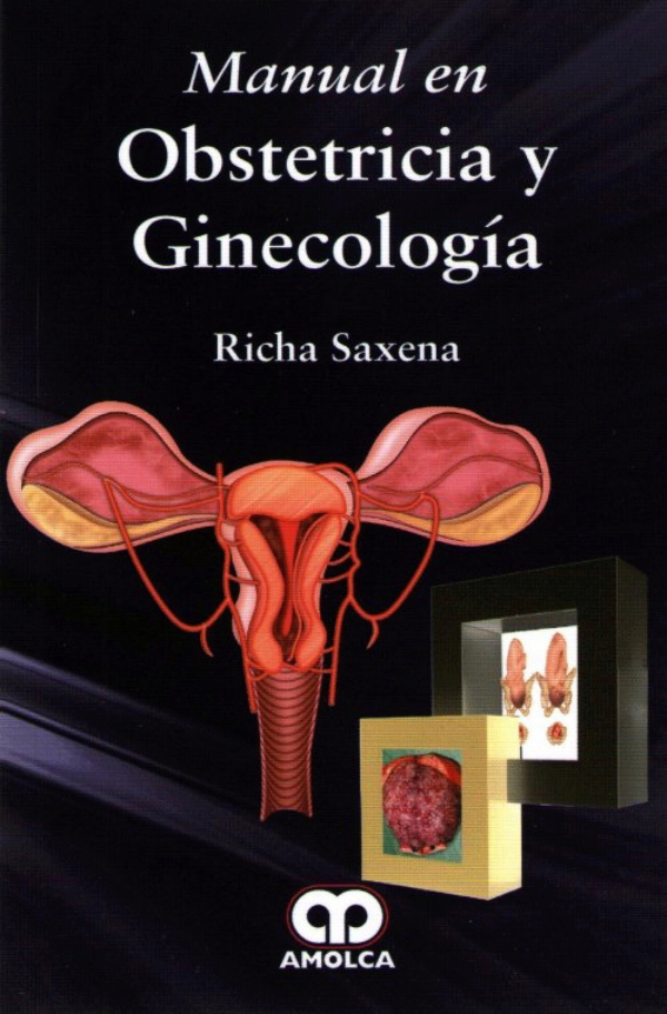 Manual En Obstetricia Y Ginecología En Laleo 3923
