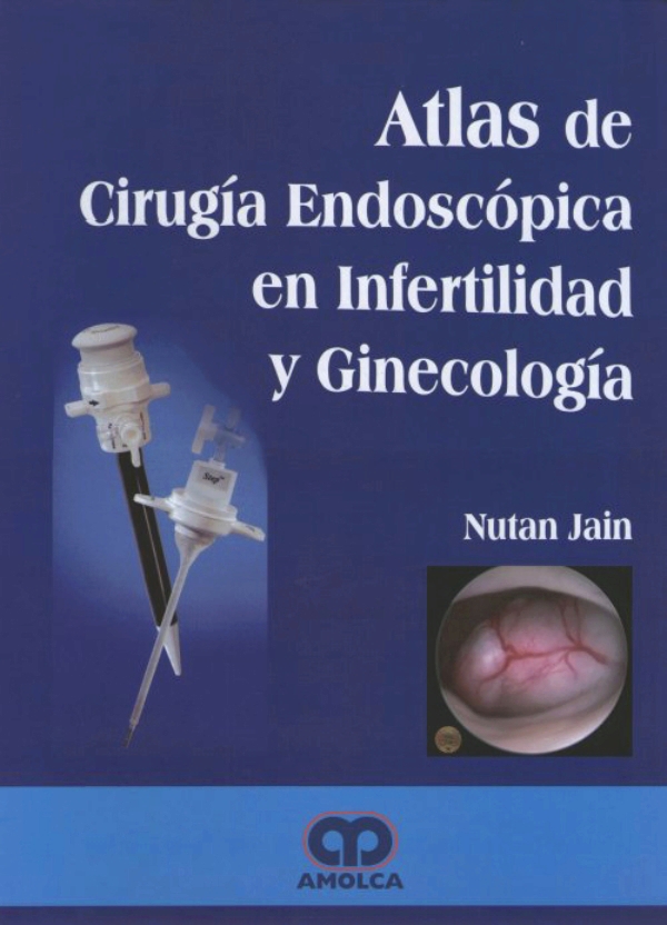 Atlas De Cirugía Endoscópica En Infertilidad Y Ginecología En Laleo 