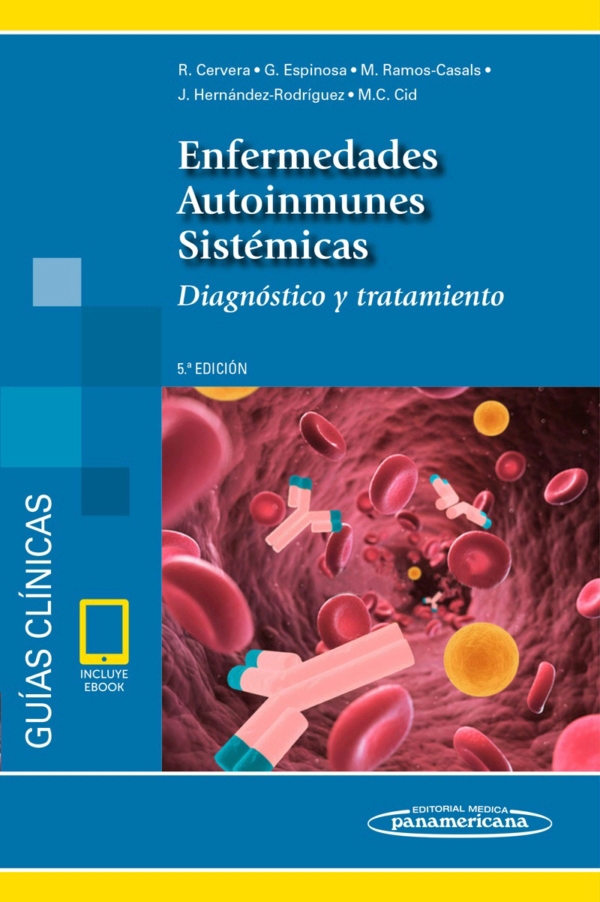 Guías Clínicas Enfermedades Autoinmunes Sistémicas En Laleo 