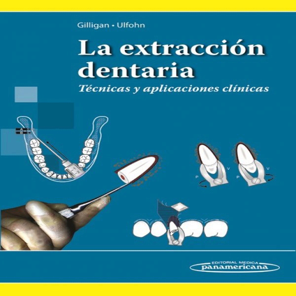 La Extracción Dentaria Técnicas Y Aplicaciones Clínicas En Laleo 3637