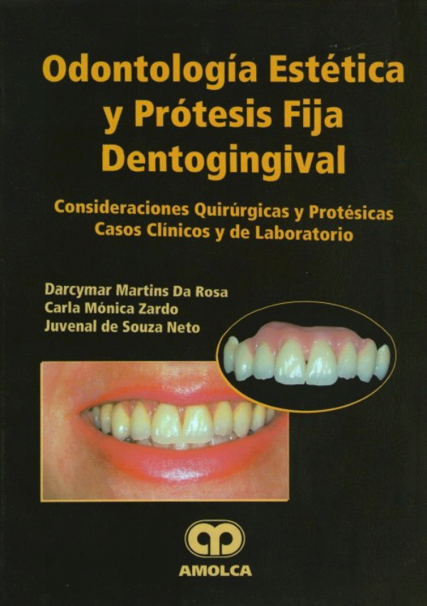https://api.laleo.com/public/images/ODONTOLOGIA/laleo_9789806574090-odontologia-estetica-y-protesis-fija-dentogingival.jpg