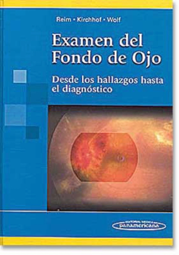 Examen Del Fondo De Ojo Desde Los Hallazgos Hasta El Diagnóstico En Laleo 8326