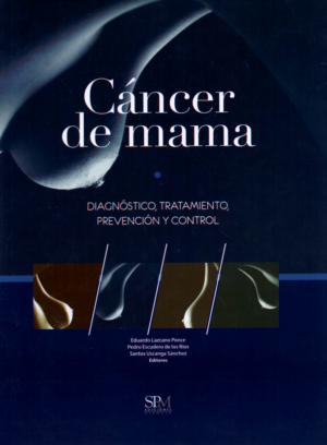 Cáncer de mama