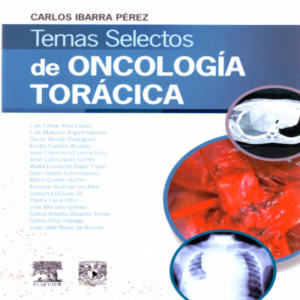 Temas selectos de oncología torácica