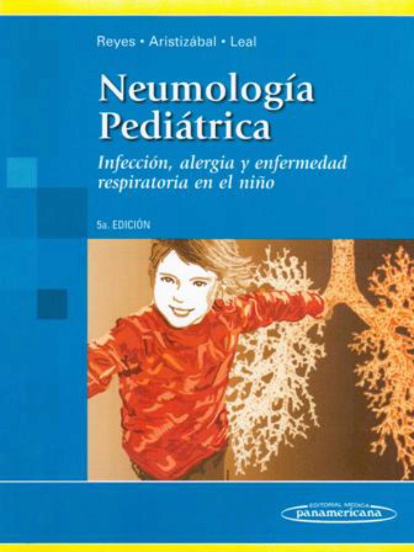 Leonora Neumonía por Streptococcus pneumoniae en adulto joven