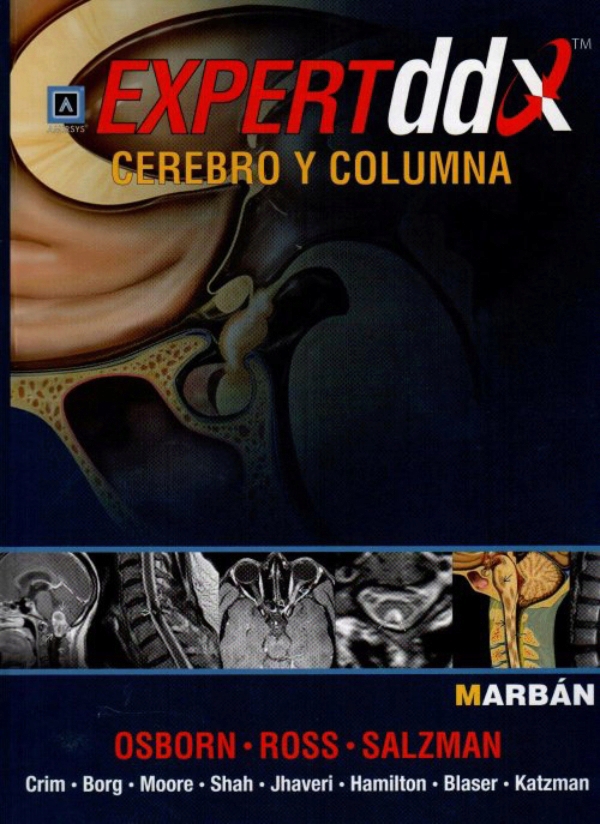 Expert DDX: Cerebro y columna en LALEO