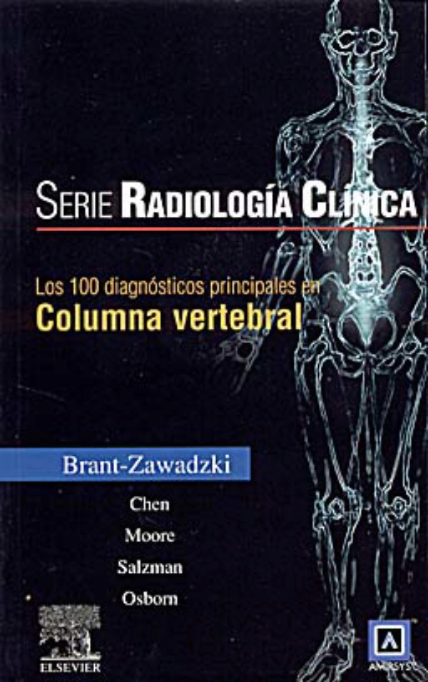 Brant. Serie Radiología Clínica: 100 Diagnósticos Principales En ...