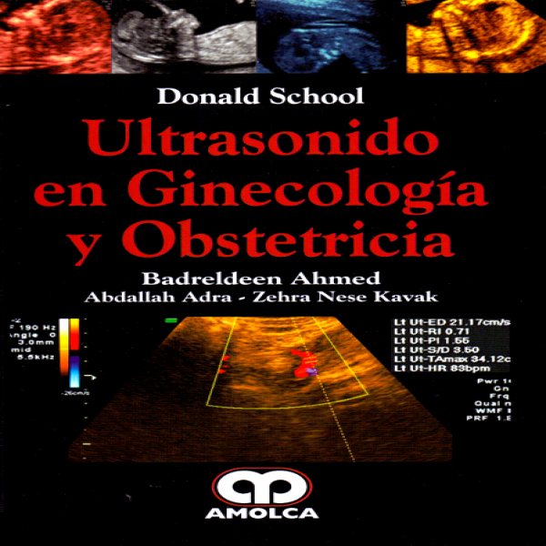 Ahmed. Donald School. Ultrasonido En Ginecología Y Obstetricia En LALEO